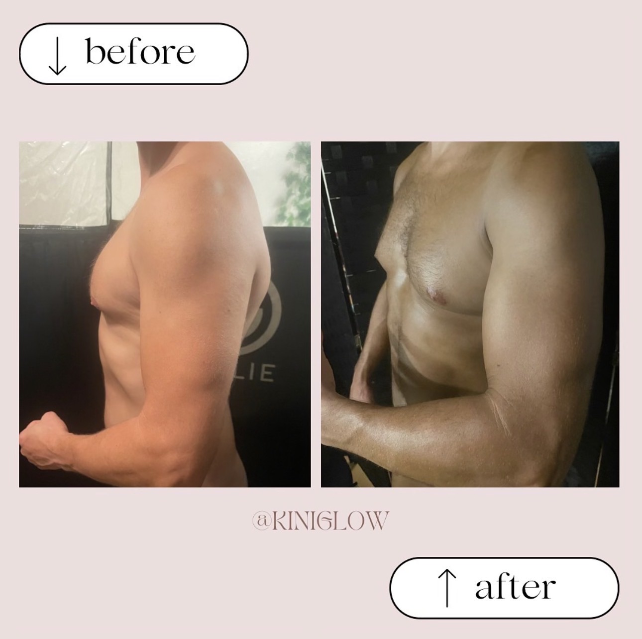 Kini Glow portfolio 11